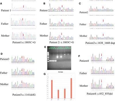 Frontiers Case Report Three Novel Variants On Slc A In Four